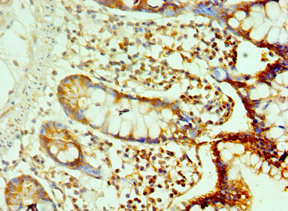 CSB-PA613267ESR1HU IHC 01