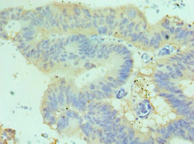 CSB-PA613267ESR1HU IHC 02