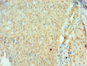 CSB-PA613674ESR2HU