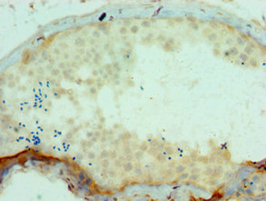 CSB-PA613674ESR2HU