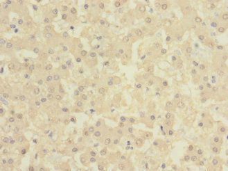Immunohistochemistry of paraffin-embedded human liver tissue using CSB-PA615684ESR2HU at dilution of 1:100
