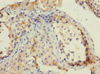 Immunohistochemistry of paraffin-embedded human testis tissue using CSB-PA617924ESR2HU at dilution of 1:100 Immunohistochemistry of paraffin-embedded human testis tissue using CSB-PA617924ESR2HU at dilution of 1:100