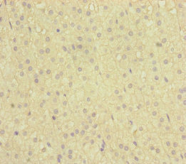 Immunohistochemistry of paraffin-embedded human adrenal gland tissue using CSB-PA617948ESR1HU at dilution of 1:100