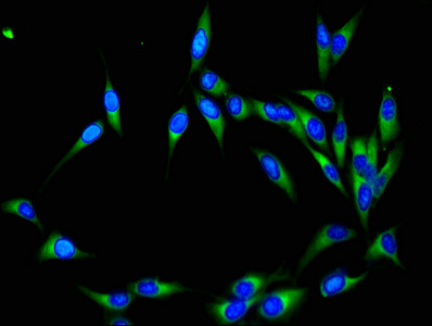Immunofluorescent analysis of Hela cells using CSB-PA618018ESR1HU at dilution of 1:100 and Alexa Fluor 488-congugated AffiniPure Goat Anti-Rabbit IgG(H+L)