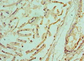 Immunohistochemistry of paraffin-embedded human prostate tissue using CSB-PA618074ESR1HU at dilution of 1:100