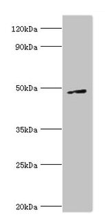 CSB-PA618772ESR1HU