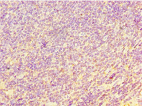 Immunohistochemistry of paraffin-embedded human tonsil tissue using CSB-PA620893ESR1HU at dilution of 1:100