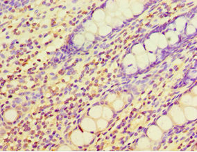 Immunohistochemistry of paraffin-embedded human colon tissue using CSB-PA620893ESR1HU at dilution of 1:100