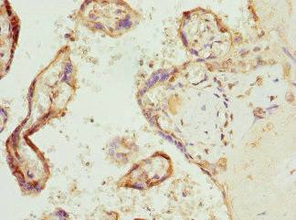 Immunohistochemistry of paraffin-embedded human placenta tissue using CSB-PA621520ESR2HU at dilution of 1:100 Immunohistochemistry of paraffin-embedded human placenta tissue using CSB-PA621520ESR2HU at dilution of 1:100