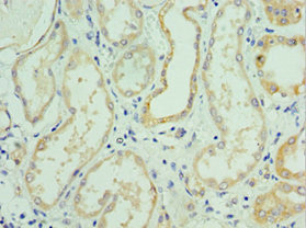 Immunohistochemistry of paraffin-embedded human kidney tissue using CSB-PA621669DSR1HU at dilution of 1:100 Immunohistochemistry of paraffin-embedded human kidney tissue using CSB-PA621669DSR1HU at dilution of 1:100