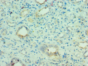 CSB-PA621968ESR1HU IF-1