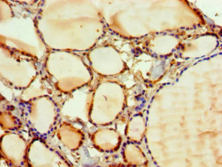 Immunohistochemistry of paraffin-embedded human thyroid tissue using CSB-PA622641DSR1HU at dilution of 1:100