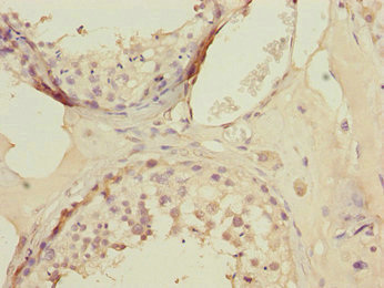 Immunohistochemistry of paraffin-embedded human testis tissue using CSB-PA622687ESR1HU at dilution of 1:100