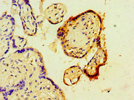 Immunohistochemistry of paraffin-embedded human placenta tissue using CSB-PA623007ESR1HU at dilution of 1:100