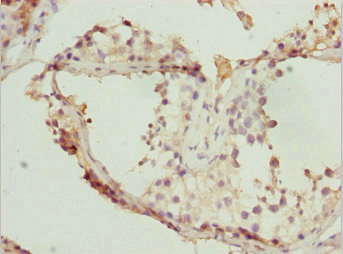 Immunohistochemistry of paraffin-embedded human testis tissue using CSB-PA624027DSR2HU at dilution of 1:100 Immunohistochemistry of paraffin-embedded human testis tissue using CSB-PA624027DSR2HU at dilution of 1:100