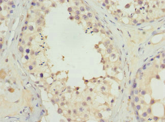 Immunohistochemistry of paraffin-embedded human testis tissue using CSB-PA667485ESR2HU at dilution of 1:100