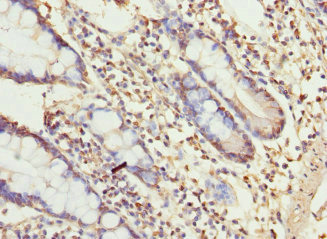 Immunohistochemistry of paraffin-embedded human small intestine tissue using CSB-PA667485ESR2HU at dilution of 1:100