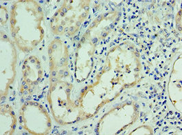 Immunohistochemistry of paraffin-embedded human kidney tissue using CSB-PA726123ESR1HU at dilution of 1:100