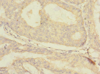 CSB-PA733704ESR1HU