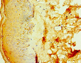 Immunohistochemistry of paraffin-embedded human skin tissue using CSB-PA740921ESR1HU at dilution of 1:100