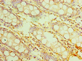 Immunohistochemistry of paraffin-embedded human colon tissue using CSB-PA740921ESR2HU at dilution of 1:100