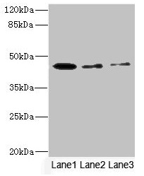 Western Blotting(WB) - SIGIRR Antibody