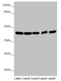 Western blot All lanes: EIF3M antibody at 2.02microg/ml Lane 1: Hela whole cell lysate Lane 2: A549 whole cell lysate Lane 3: Mouse gonadal tissue Lane 4: Human placenta tissue Lane 5: Mouse brain tissue Secondary Goat polyclonal to rabbit IgG at 1/10000 dilution Predicted band size: 43, 28 kDa Observed band size: 43 kDa