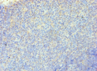 Immunohistochemistry of paraffin-embedded human tonsil tissue using CSB-PA745339ESR2HU at dilution of 1:100