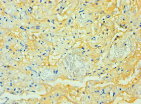 CSB-PA753711DSR1HU