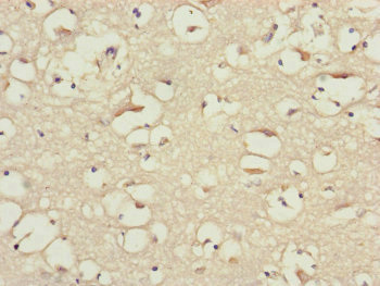 Immunohistochemistry of paraffin-embedded human brain tissue using CSB-PA754307ESR1HU at dilution of 1:100