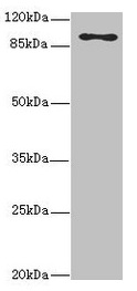 Western blot All lanes: MTHFD1L antibody at 3.68microg/ml + Hela whole cell lysate Secondary Goat polyclonal to rabbit IgG at 1/10000 dilution Predicted band size: 106, 30 kDa Observed band size: 106 kDa