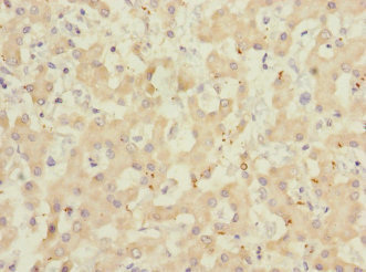 Immunohistochemistry of paraffin-embedded human liver tissue using CSB-PA761506ESR1HU at dilution of 1:100 Immunohistochemistry of paraffin-embedded human liver tissue using CSB-PA761506ESR1HU at dilution of 1:100