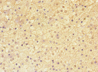 Immunohistochemistry of paraffin-embedded human adrenal gland tissue using CSB-PA761506ESR1HU at dilution of 1:100