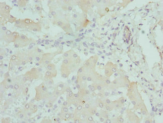 Immunohistochemistry of paraffin-embedded human liver tissue using CSB-PA772022ESR2HU at dilution of 1:100