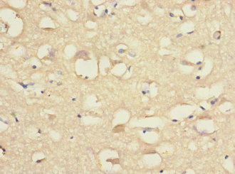 Immunohistochemistry of paraffin-embedded human brain tissue using CSB-PA810284ESR2HU at dilution of 1:100