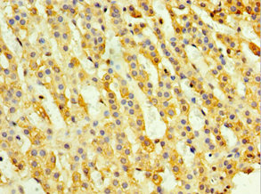 CSB-PA815573ESR2HU IHC