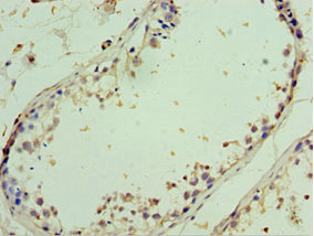 Immunohistochemistry of paraffin-embedded human testis tissue using CSB-PA819153ESR1HU at dilution of 1:100