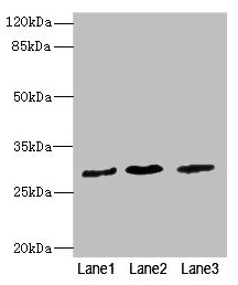 CSB-PA822281ESR1HU