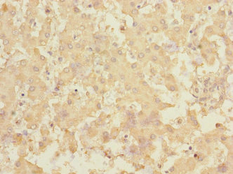 CSB-PA822281ESR2HU