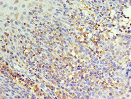Immunohistochemistry of paraffin-embedded human tonsil tissue using CSB-PA822717ESR2HU at dilution of 1:100