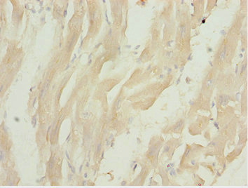 Immunohistochemistry of paraffin-embedded human heart tissue using CSB-PA836674ESR1HU at dilution of 1:100