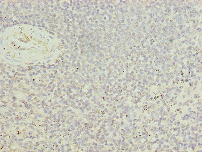 Immunohistochemistry of paraffin-embedded human spleen tissue using CSB-PA840585ESR2HU at dilution of 1:100
