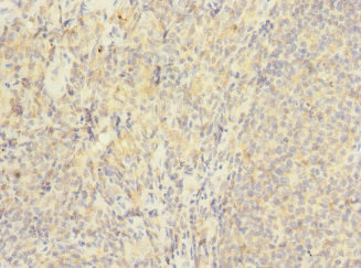 Immunohistochemistry of paraffin-embedded human tonsil tissue using CSB-PA846602ESR1HU at dilution of 1:100