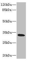 Western blot All lanes: HVCN1 antibody at 1.17microg/ml + Raji whole cell lysate Secondary Goat polyclonal to rabbit IgG at 1/10000 dilution Predicted band size: 32, 28, 30 kDa Observed band size: 32 kDa Western blot All lanes: HVCN1 antibody at 1.17microg/ml + Raji whole cell lysate Secondary Goat polyclonal to rabbit IgG at 1/10000 dilution Predicted band size: 32, 28, 30 kDa Observed band size: 32 kDa