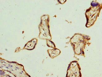 Immunohistochemistry of paraffin-embedded human placenta tissue using CSB-PA850247ESR1HU at dilution of 1:100
