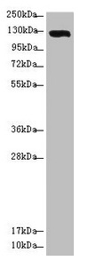 Western blot All lanes: USP28 antibody at 3.08microg/ml + Hela whole cell lysate Secondary Goat polyclonal to rabbit IgG at 1/10000 dilution Predicted band size: 123, 120, 67 kDa Observed band size: 123 kDa