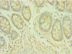 Immunohistochemistry of paraffin-embedded human colon tissue using CSB-PA850918ESR1HU at dilution of 1:100 Immunohistochemistry of paraffin-embedded human colon tissue using CSB-PA850918ESR1HU at dilution of 1:100