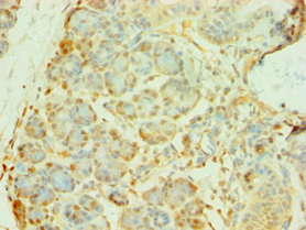 Immunohistochemistry of paraffin-embedded human pancreatic tissue using CSB-PA850918ESR1HU at dilution of 1:100