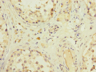 Immunohistochemistry of paraffin-embedded human testis tissue using CSB-PA855487DSR1HU at dilution of 1:100
