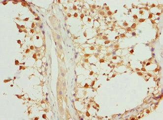 Immunohistochemistry of paraffin-embedded human testis tissue using CSB-PA857466DSR1HU at dilution of 1:100